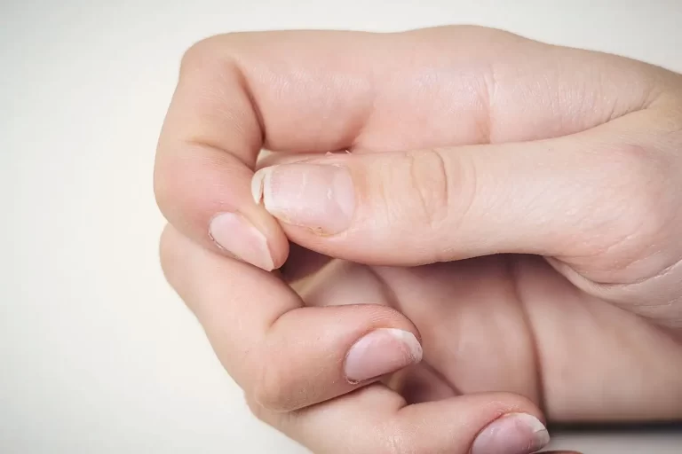 Что делать если ногти очень тонкие и мягкие?